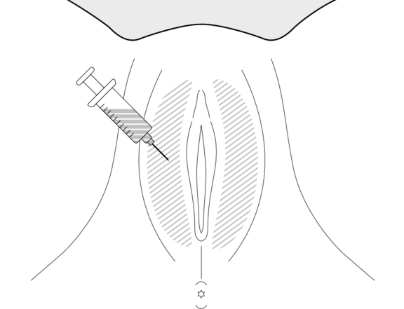 Intimchirurgie, Plastische Chirurgie Berlin, AesthetiCum, Dr. Ahrens, Dr. Fritzsch
