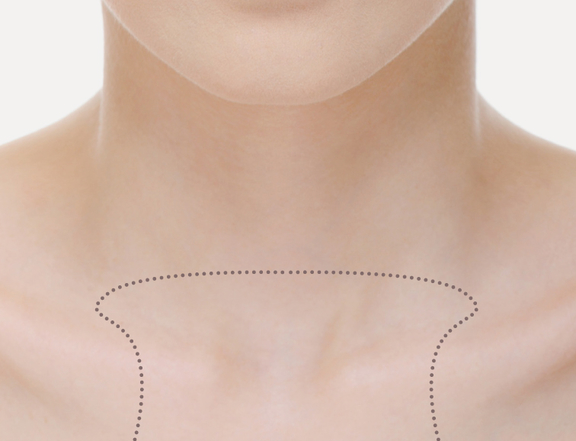 Faltenunterspritzung Dekolleté, Plastische Chirurgie Berlin, AesthetiCum, Dr. Ahrens, Dr. Fritzsch