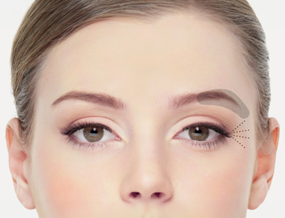 Augenbrauenlift, Plastische Chirurgie Berlin, AesthetiCum, Dr. Ahrens, Dr. Fritzsch