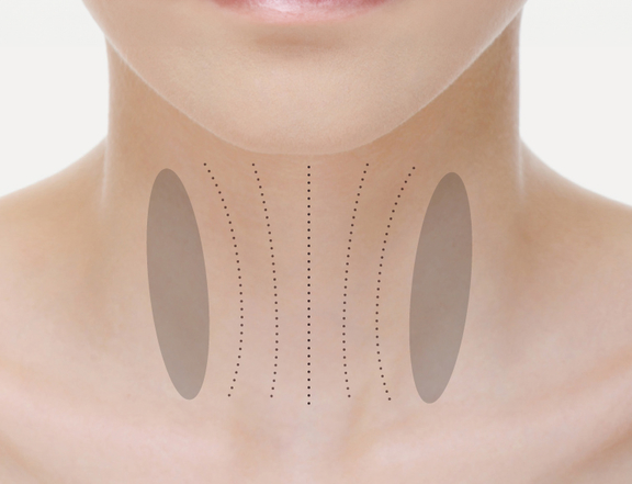 Halsfalten, Plastische Chirurgie Berlin, AesthetiCum, Dr. Ahrens, Dr. Fritzsch