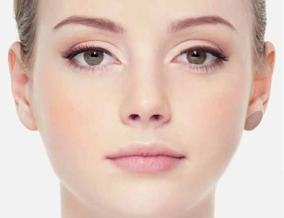 Ohrläppchen unterspritzen, Plastische Chirurgie Berlin, AesthetiCum, Dr. Ahrens, Dr. Fritzsch